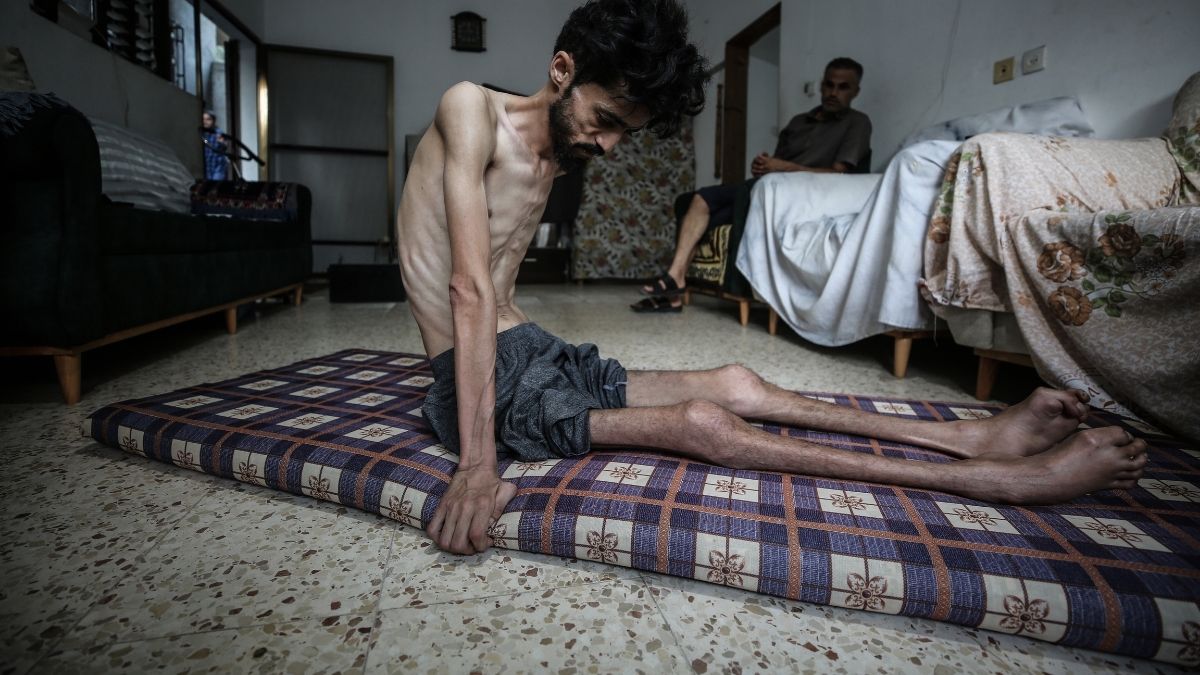 Gazze'de abluka can almaya devam ediyor: 117'si çocuk, 303 kişi açlıktan hayatını kaybetti