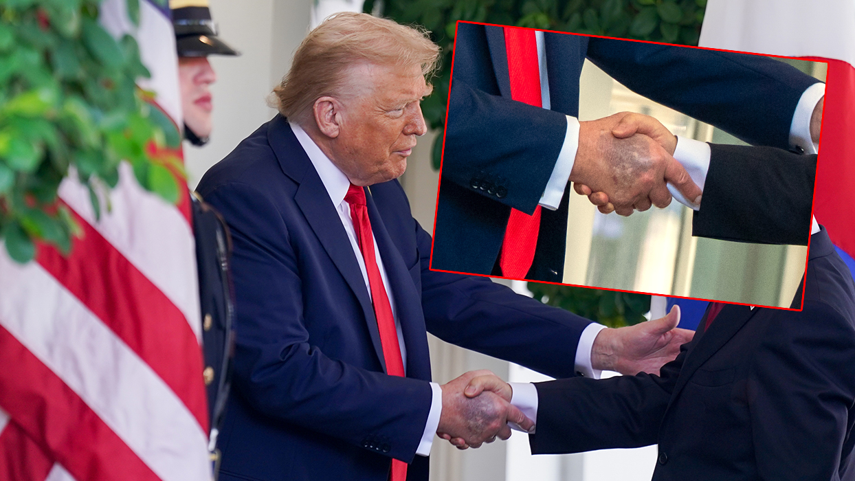 Trump'ın elindeki morluk dikkat çekti... Beyaz Saray'dan açıklama