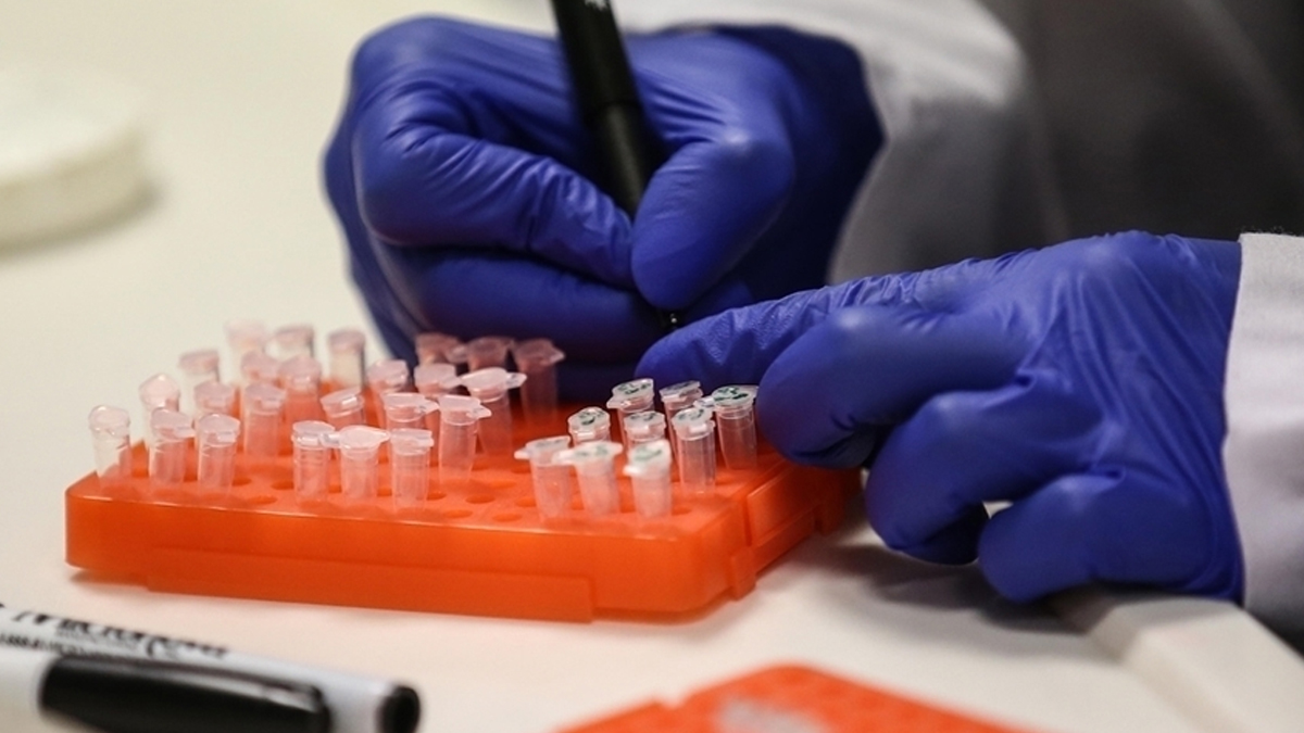 M çiçeği vakaları 565'e yükseldi: Gana hükümeti ilk ölüm haberini duyurdu