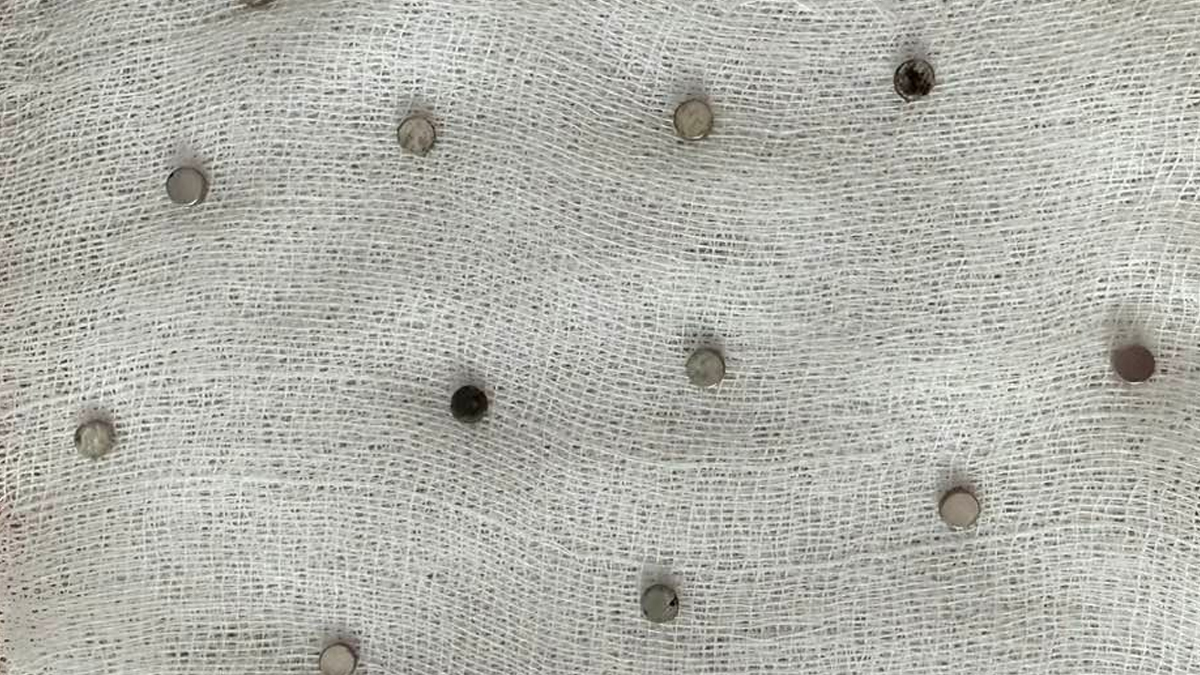 V Turčiji triletniku iz požiralnika odstranili 19 magnetov