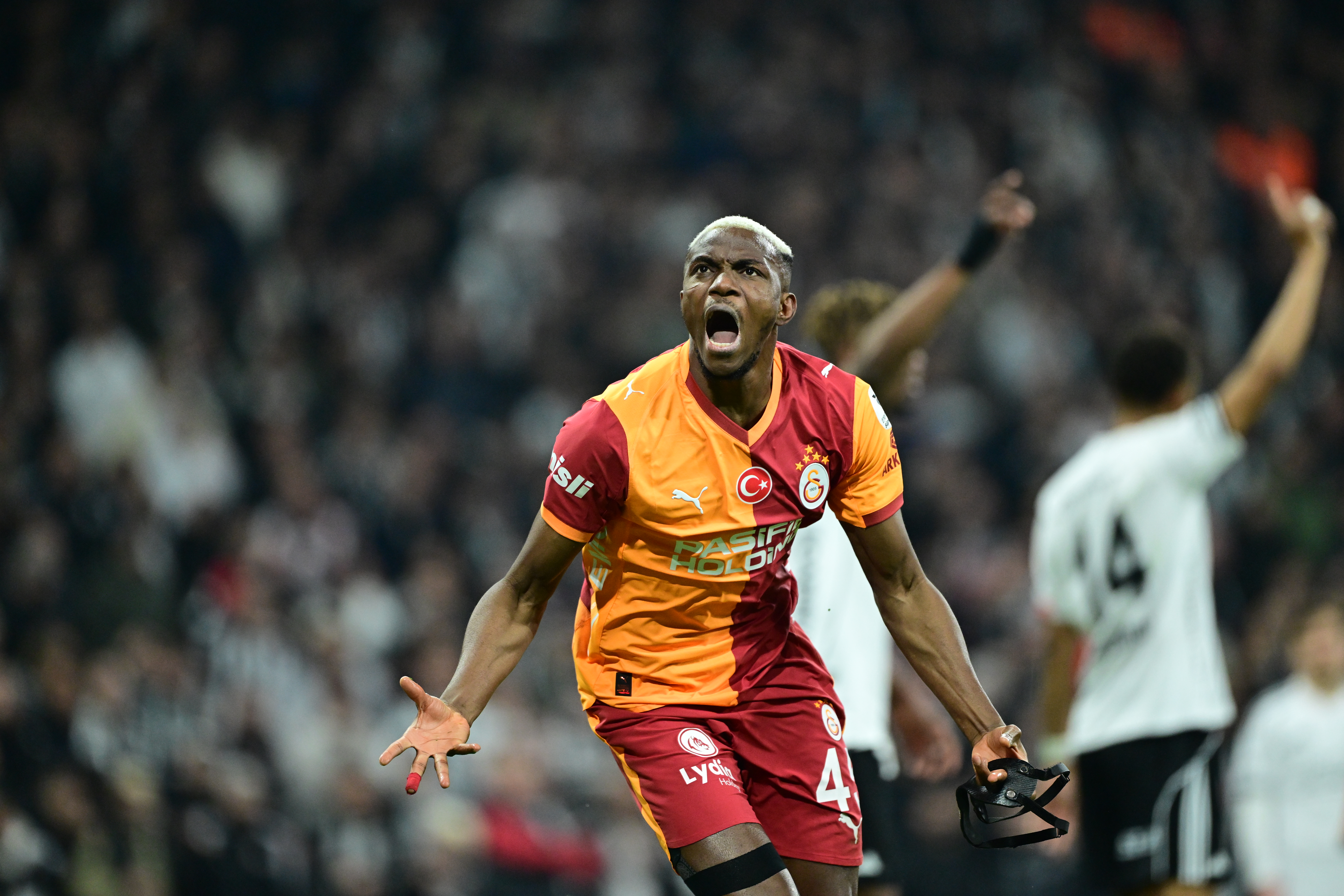 Galatasaray'dan Victor Osimhen açıklaması! Ameliyata alındı
