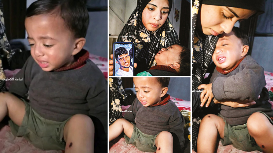 Bacaklarında sigara söndürdüler! 1 yaşındaki bebeğe siyonist işkence