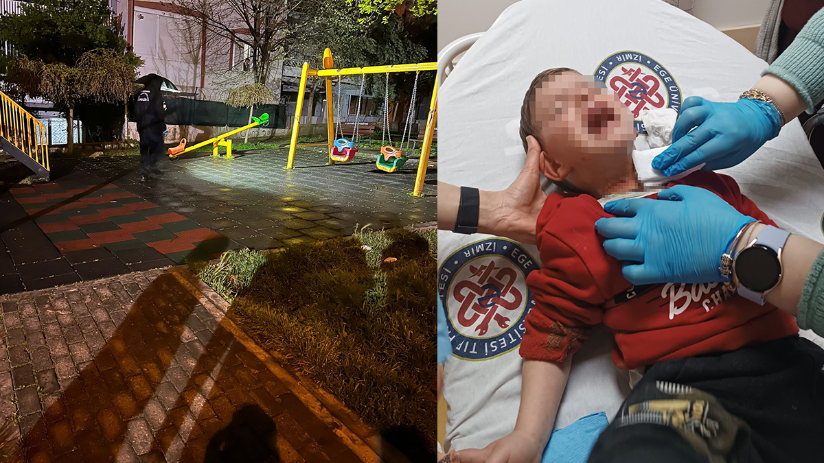 Parkta korkunç olay: 2 yaşındaki çocuğu boğazından yaraladı