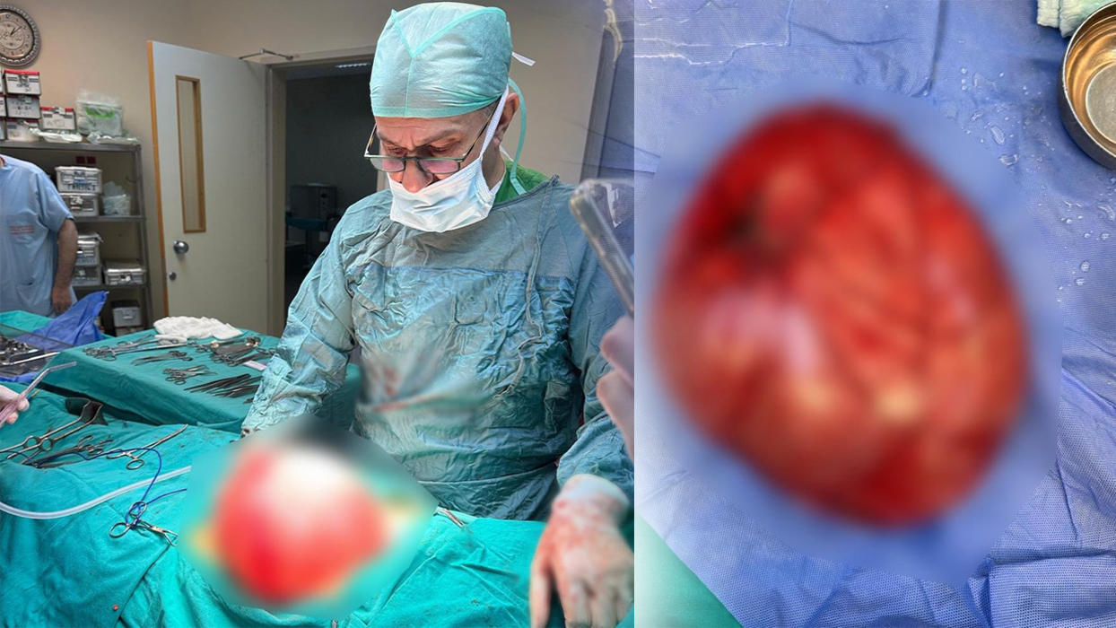 14 yaşındaki çocuğun karnından 3.5 kilo kist çıktı
