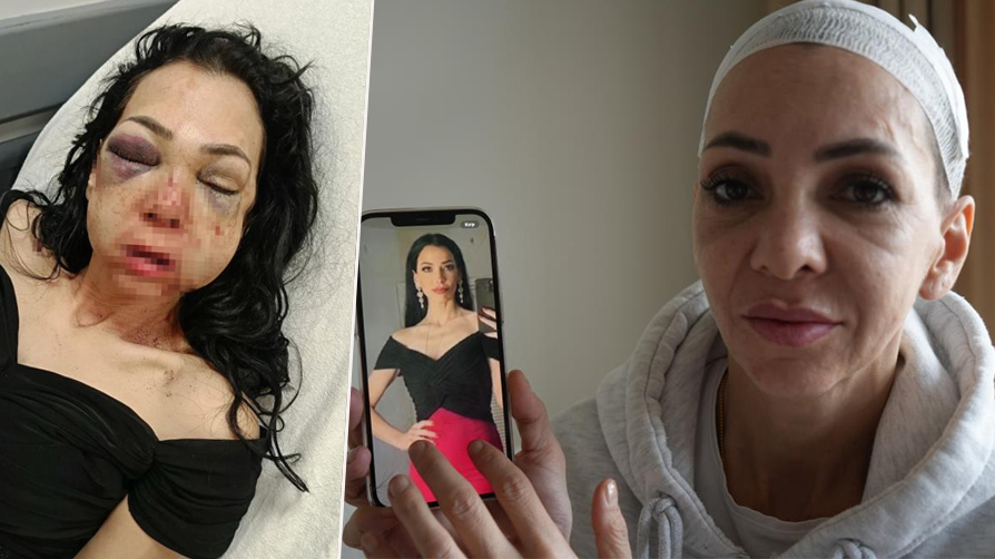 Anneyi öldüresiye dövenler vukuatlı çıktı! Savunmaları pes dedirtti