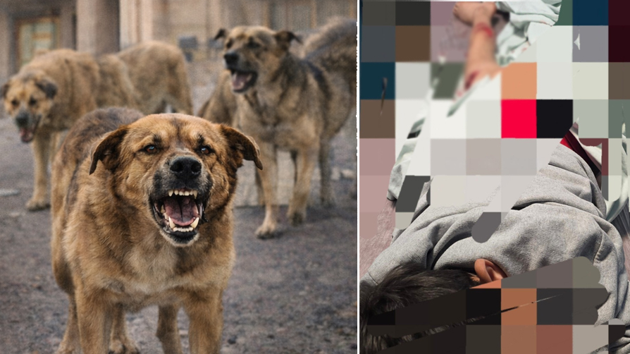 Sokak köpeği dehşeti: 11 yaşındaki çocuğu parçalayacaktı