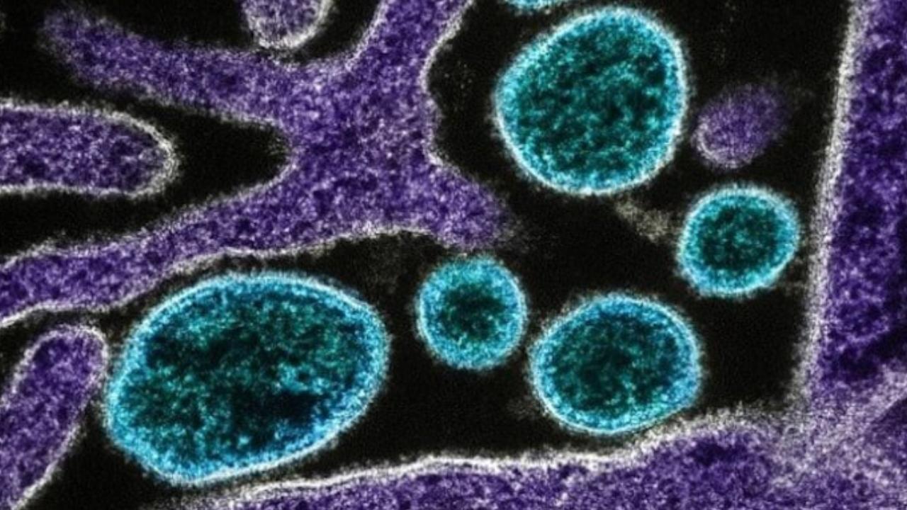 60 yıl sonra ilk defa görüldü: ABD'de parazit paniği