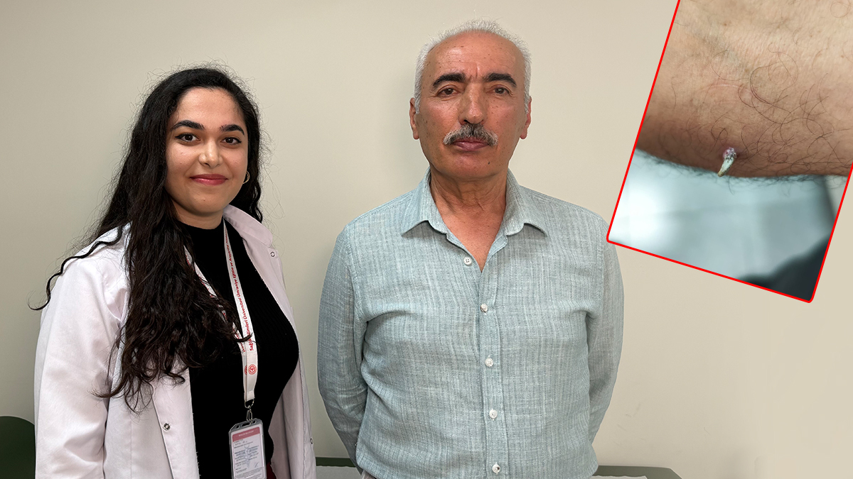Kolundaki yara için doktora gitti! Erken teşhis hayatını kur