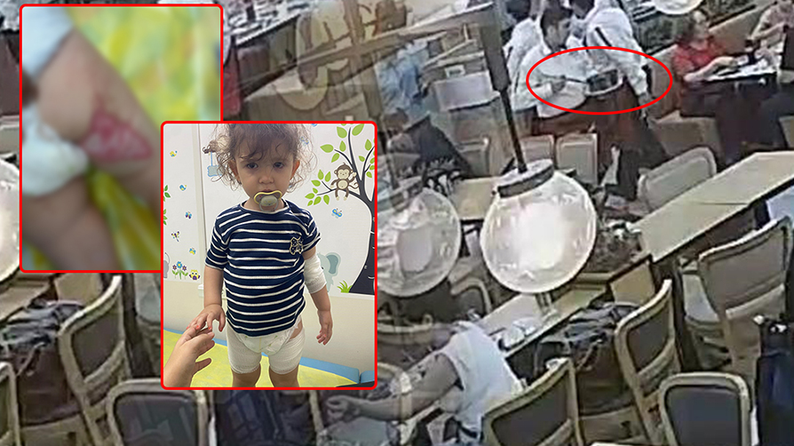 "Tereyağı şovu" faciaya dönüştü: Acı çığlıklar restoranı aya